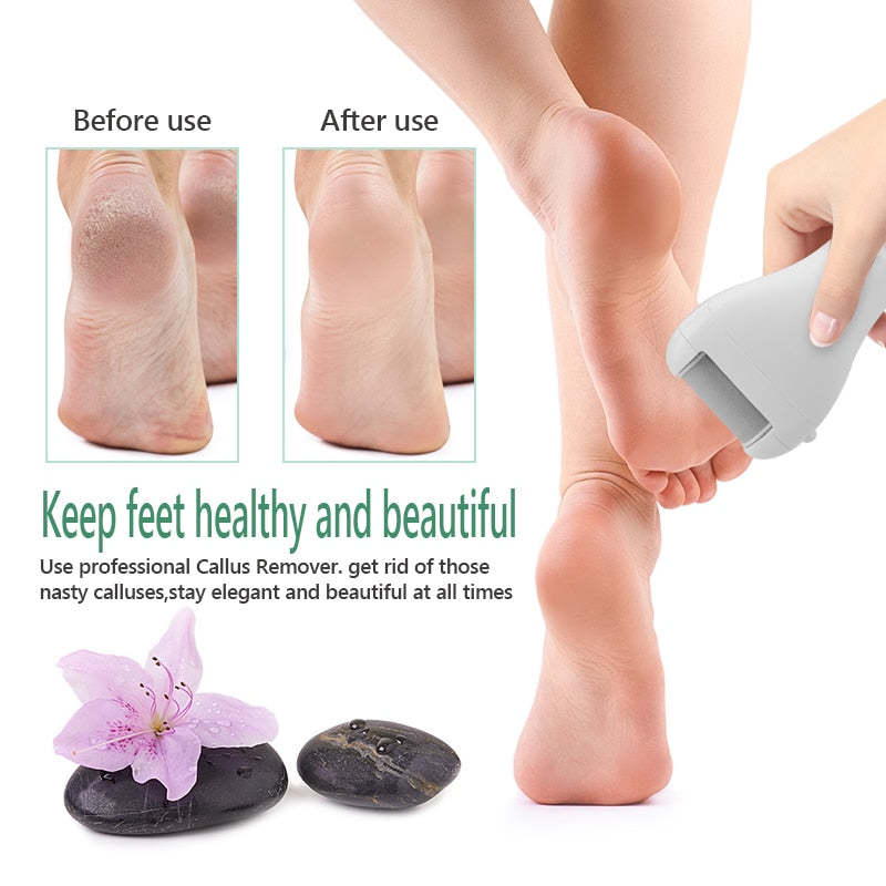 Rechargeable Electric Foot File Callus Remover