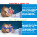 Anti Snoring Chin Strap Sleep Support
